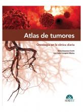 ATLAS DE TUMORES ATLAS DE TUMORES